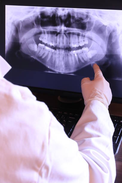 Best Emergency Dentist for Lost Fillings or Crowns in East Quogue, NY